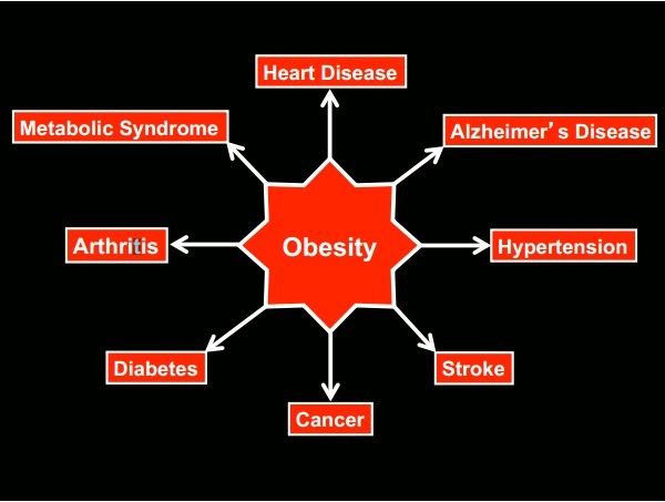obesity-modern-diseases