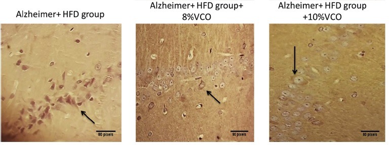 VCO Alzheimer study images